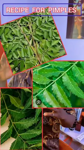Effective remedy for pimples, dark spot.. very powerful recipe 