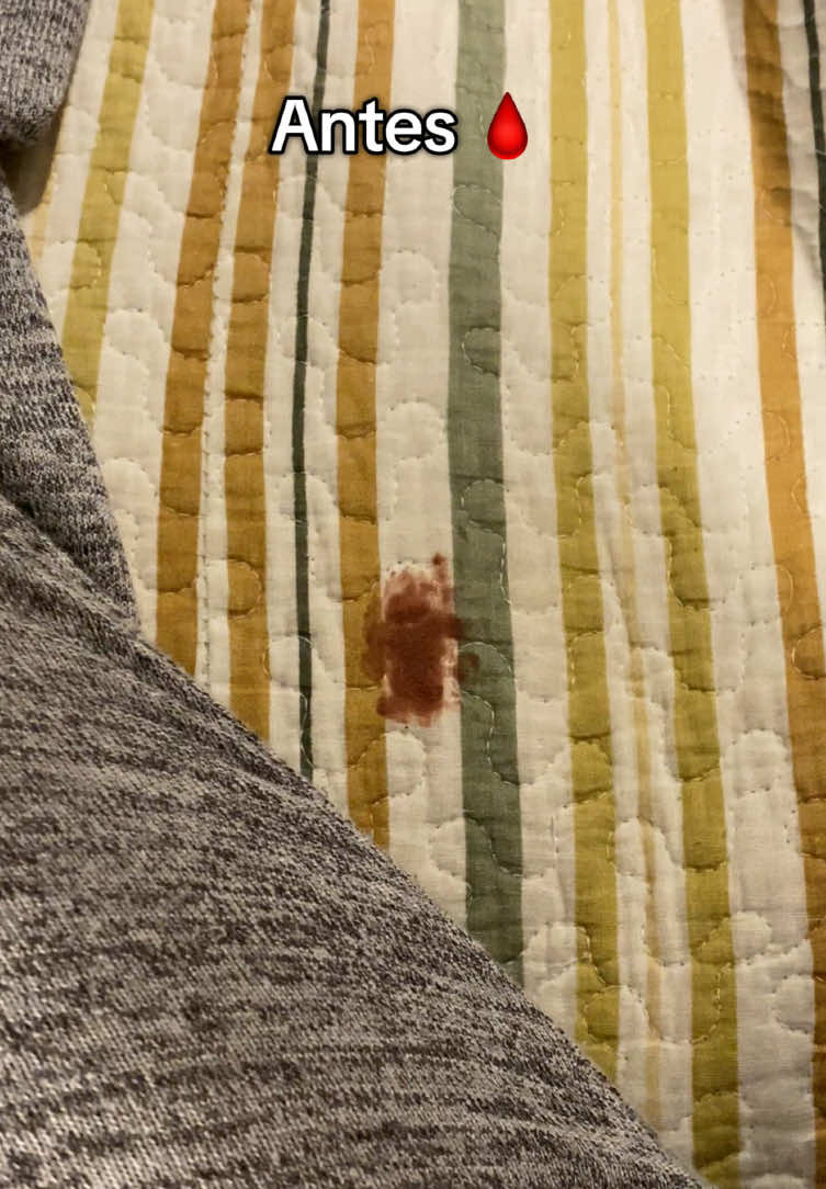 Manchas inesperadas en el peor momento?🩸😬Esta es la solución 🤩 #stainremover #stain #cleaning #ropalimpia #quitamanchas #CleanTok #gadget #stainresistant #manchas #periodo #españa #mexico #chile                                                 Fake Bl00d‼️⚠️