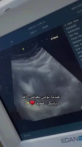 #ولا_للحامل🥺❤️‍🔥 #يارب_فوضت_امري_اليك #الحمدله_دأمن_🧿وأبدا🧿 #يقومك_بسلامه_روحي😍❤ #ايمت_اوصل100k✨ #كليوم_فيديو🇩🇿_جديد💥💪 