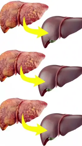 чистить печени и организм#пить#здоровье#drink#health#fyp 