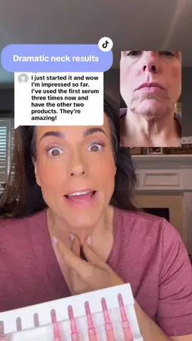 Replying to @🦒✨South_AfriCan ✨🐏 if you don’t believe me that’s fine but there are plenty of others who are having amazing results with this neck regimen. #DrMelaxinNeckCare #NecksphaltTreatment #TightenYourNeck #AgelessNeckRoutine #SkincareThatWorks @Dr.Melaxin Global 