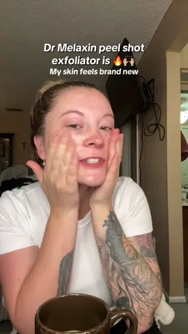 I really just wanted to show the glow my skin has after using the black rice peel shot exfoliator last night, my makeup goes on so good now and my skin can actually soak up my skincare now 🙌🏼