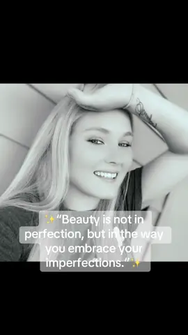 #fyp  #Beauty is not in perfection, but in the way you embrace your imperfections.” 