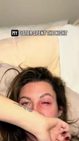 Be careful girls #girl #eyes #hospital #woman #story 