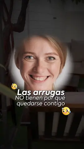 ✨ Dile adiós a las arrugas y hola a una mirada fresca. Con bótox, suaviza patas de gallo y líneas de expresión en minutos, de forma segura y natural. 📅 Agenda tu cita en Alma Centro Estético Láser y rejuvenece hoy mismo. #belleza #estetica #botox #ciudatupiel #Tacna 