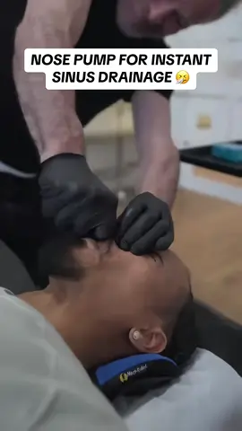 This technique is called 'Cranial Facial Release. SHARE this video to your local Chiropractor to see if you need this. 🤗#satisfying #oddlysatisfying #foryou #fyp #allergy (via Dr. Doug Willen in NYC)