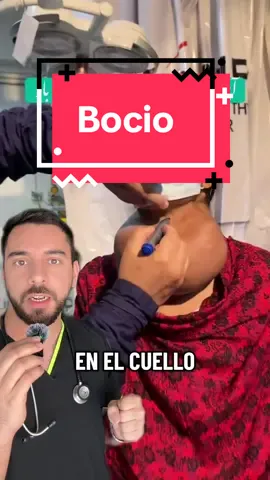 📍 Lo que ves es un bocio gigante: la tiroides crece de forma anormal. 🥄 La causa más frecuente en el mundo: no incorporar suficiente yodo en la dieta. 📍 Aún se ve en regiones donde no hay suficiente yodo en la dieta y el acceso a tratamiento es limitado. 🧂 En América casi no se ve porque la sal yodada previene este problema. #Medicina #Salud #Bocio #Endocrinología #TikTokCiencia