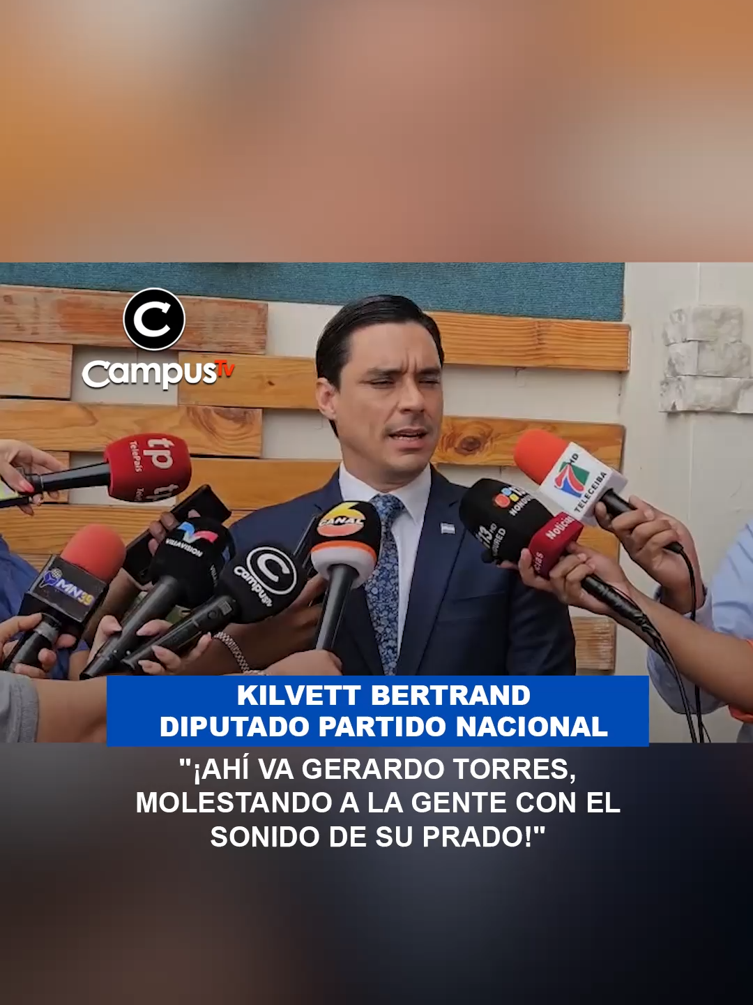 Kilvett Bertrand lo volvió hacer  El diputado del Partido Nacional, Kilvett Bertrand, queda sorprendido ahora al ver la prado que llevaba Gerardo Torres  