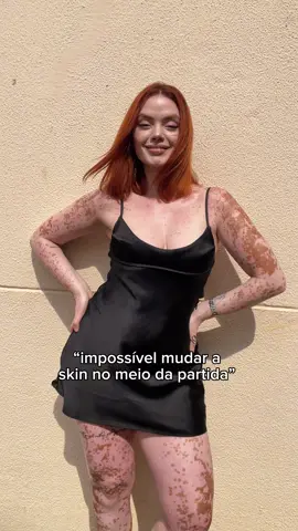 quando o gamer é Deus ele muda kk 😙#penaquenaoemeucaso #vitiligo #vitiligouniversal #mudança #trend 