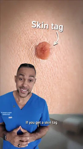 Skin tags might look easy to remove, but here's why you shouldn't do it yourself and what dermatologists recommend instead. Brought to you by #CeraVe.