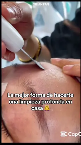 La paleta ultrasónica es la mejor forma de hacerte una limpieza 🧼 facial profunda desde casa 🏠 si quieres probarla dale clic al enlace limpiador ultrasonico facial limpiador facial ultrasónico ecuador limpiador facial ultrasónico ecuador espatula ultrasonica ecuador #reducilicos #limpiadorfacial #limpiezafacial #limpiadorultrasonico #cuidadodelapiel   