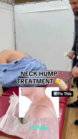 would you try this gentle and relaxing treatment? 😱 (via hanif._7) #foryou #chiropractor #asmr #StressRelief 