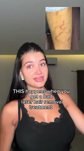 Please go to a good laser hair removal studio with professional people & tools 🥹✨ so that you don’t get burned like me or told wrong information like 
