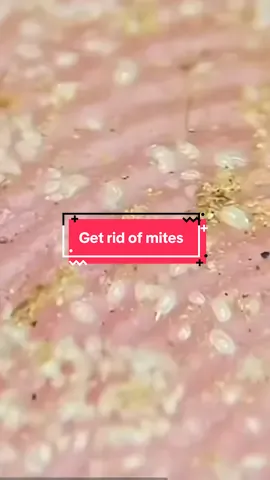 Use this if you want a clean bed and get rid of insects #fyp #bed #mites #bedbugs 