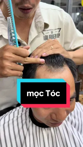 Bị hói trán M, rụng tóc , tóc thưa và hói thì cứ dùng lăn mọc tíc hairbon này, 1 tháng sẽ thấy cải thiện, cố gắng 2,3 tháng là tóc sẽ mọc lại nhen anh chị#hairborn #duongtoc #lantochairborn #giamrung #lanmoctoc 
