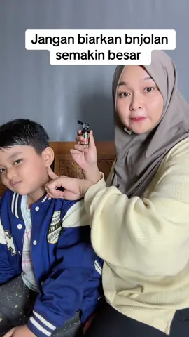 Jangan biarkan bnjolan jadi smakin besar boleh bantu oles rutin 3x sehari dg minyak khusus bnjolan #benjolan #minyak 