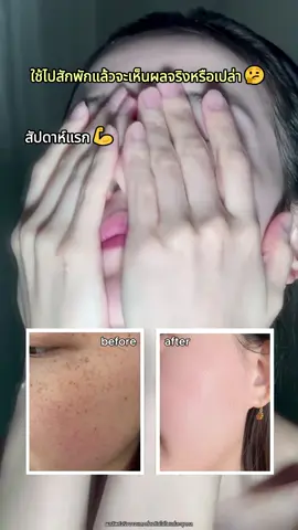 💦   ครีมใบหน้า 3x + 5x สามารถสร้างความชื้นสองเท่า! รีบมารับมัน#papafeel#papafeelth#papafeelเช้าcเย็นa#เช้าcเย็นa#papafeel3xretinol#papafeel5xceramide
