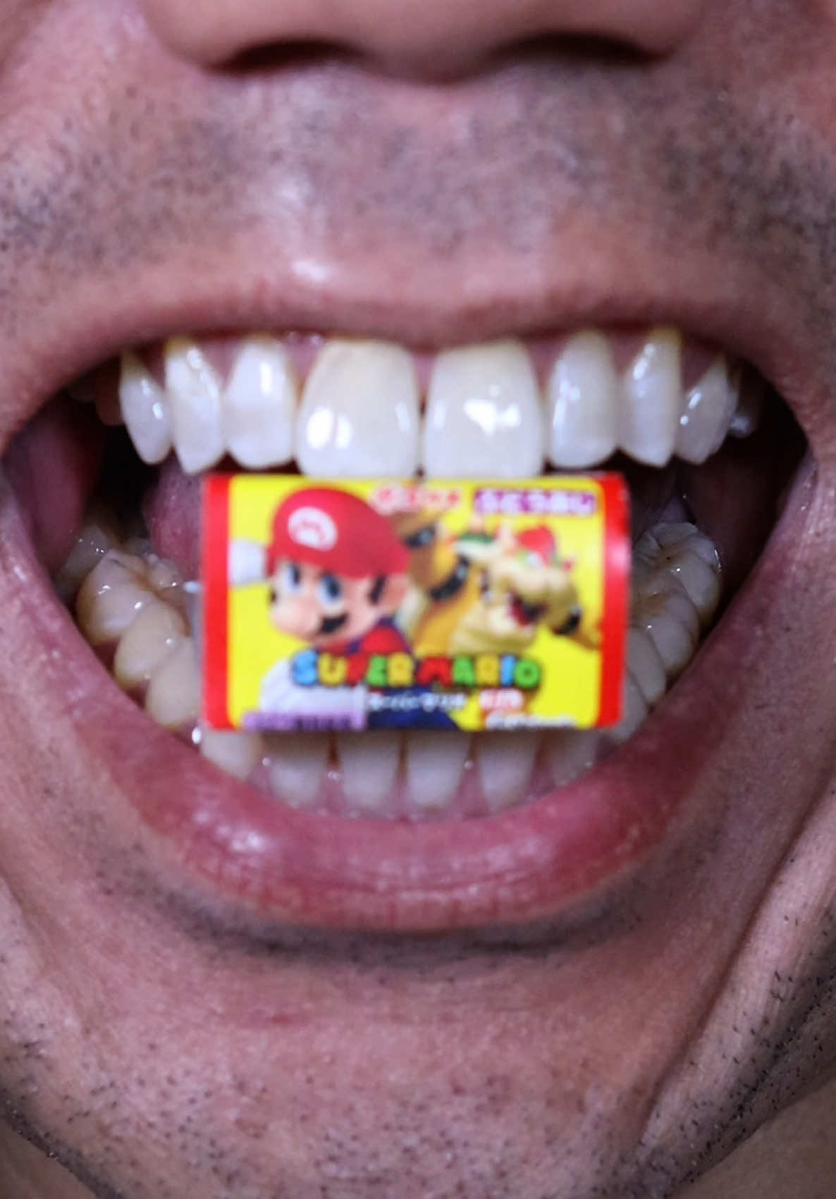 ASMR | Super Mario vs Bowser Gum 🍬 Fun Japanese Treat & Satisfying Sounds #DoctorTristanPeh #ASMR