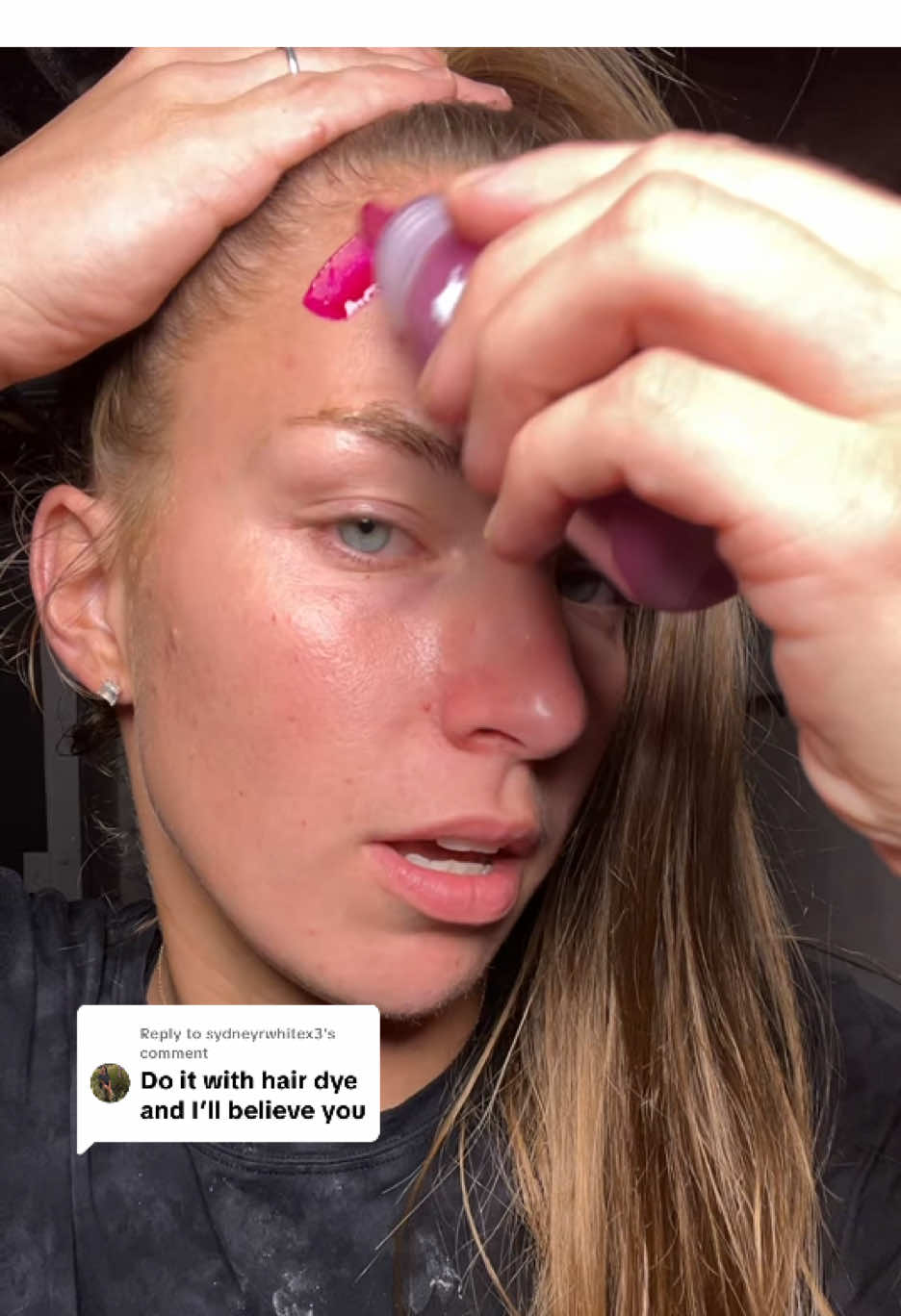 Replying to @sydneyrwhitex3 black heads, dead skin, HAIR DYE @Dr.Melaxin Global has you covered cause the best chemical exfoliant👏🏼 ##drmelaxin##peelshot##hairdye