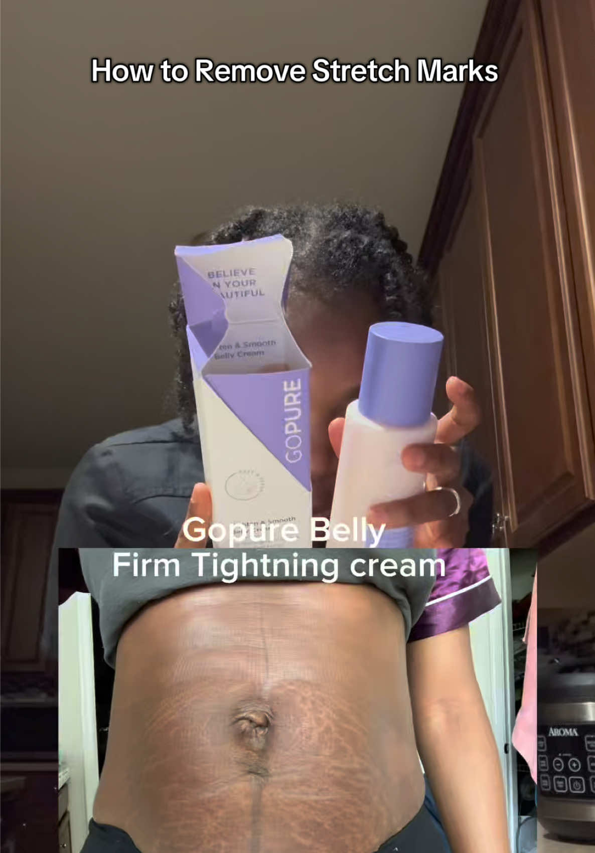 If you have sturbon stretch marks, use this new GOPURE Tighten & Smooth Belly firming cream. @Gopure  #gopuresuperbrandday #confidenceatyourcore #mybellymystory #tightensmoothbelllycream #aishaskns 