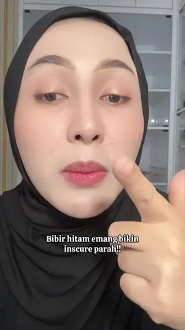 Jangan sampai bibir hitam bikin kamu insecure