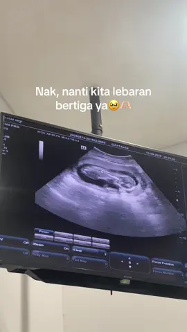 Sehat sehat sayangku 🫶🏻 #masyaallahtabarakkallah #allahummabarik #pejuanggarisdua #trimester2 #hamil #bumilsehat #bumilhappy #penantianbuahhati #pregnancy #pregnant 