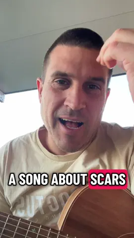Do you have a scar story? Show me your scar and tell me how you go it! #scar #scarstory #howdyougetthat @Ryan Martin 