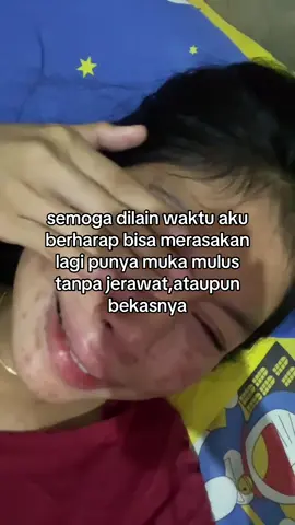 dan aku berharap waktu itu segera datang☺️#acnefighter #acne #jerawat #jerawatan #fypage 
