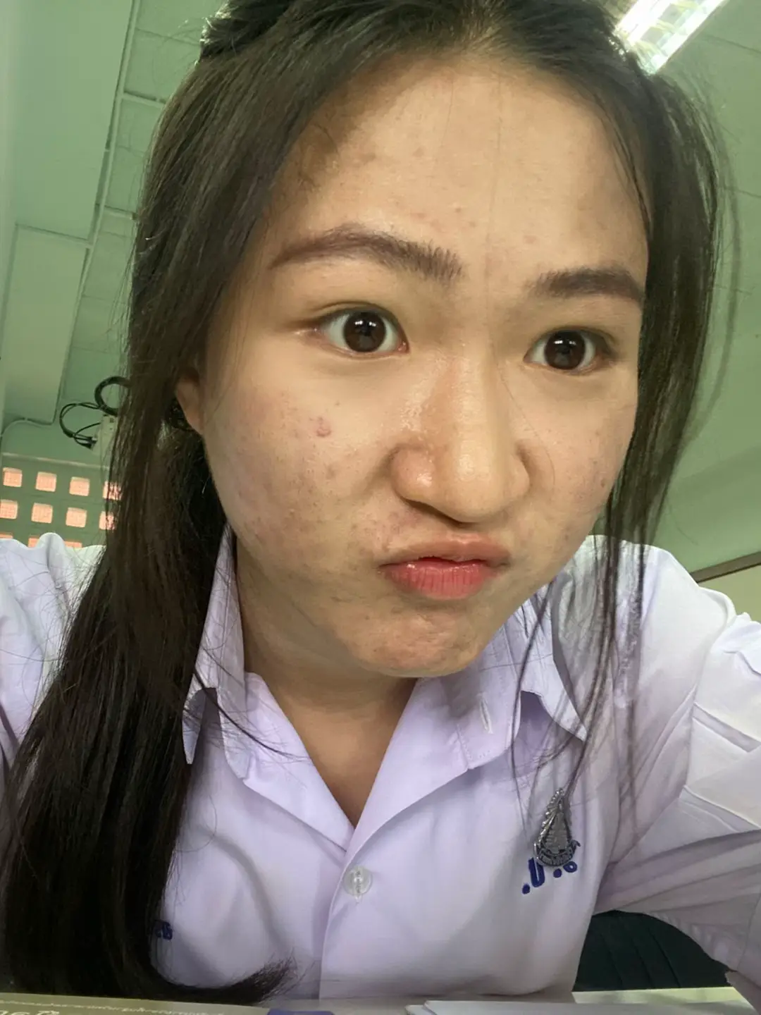 แบรนด์นี้ทำถึงเกินนน จะบ้าาาา ละสูตรใหม่ปังกว่าเดิมอีกกก #หน้าใส #สิวยุบ #รูขุมขนกระชับ 