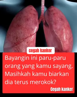 Dampak Rokok pada Paru-paru Setiap hisapan rokok mengandung lebih dari 7.000 zat kimia berbahaya. Nikotin menyebabkan kecanduan, tar menempel di dinding paru, karbon monoksida menggantikan oksigen dalam darah. Lama-kelamaan paru-paru perokok dipenuhi endapan tar, menjadi hitam, dan kehilangan elastisitasnya. 🔴 Penyakit yang Mengancam PPOK (Penyakit Paru Obstruktif Kronis) → sesak napas, batuk kronis, produksi dahak berlebihan. Kanker paru-paru → risiko perokok 15–30 kali lebih tinggi dibanding bukan perokok. Infeksi paru (bronkitis, pneumonia) lebih mudah terjadi. Penurunan fungsi paru → cepat lelah, sulit bernapas. 🔴 Tanda-Tanda Paru-paru Bermasalah Batuk terus-menerus, sering berdahak. Sesak napas walau aktivitas ringan. Dada terasa berat atau nyeri. Sering sakit paru atau infeksi berulang. 🔴 Setiap batang rokok merusak paru-paru. Lebih cepat berhenti, lebih besar peluang paru Anda pulih. KONSULTASI KAN KESEHATAN MU ( FREE )DAN CEGAH KANKER PARU - PARU ‼️ HUB WHATSAPP: 085169387896 . #paruparu #rokok #fyp#foryou #cegahkanker 