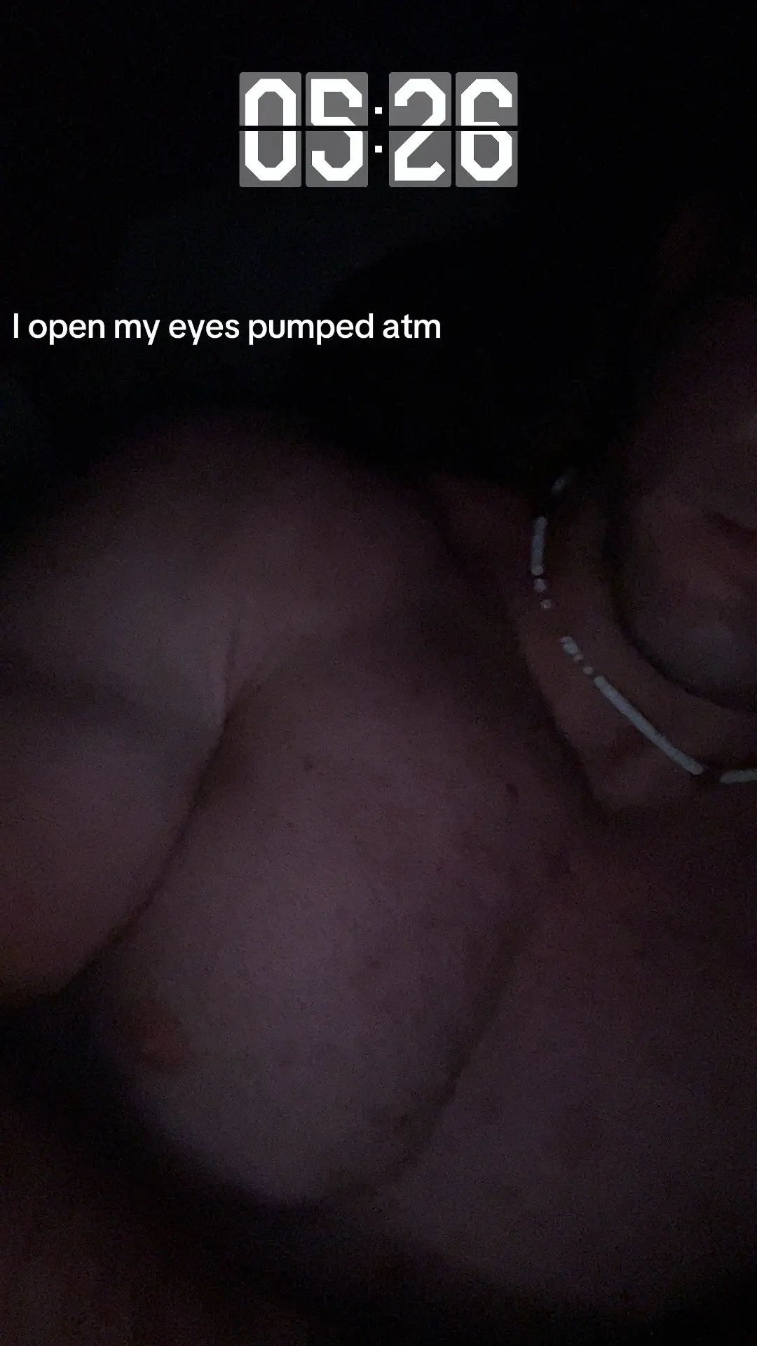 Upper chest separation looking nice #gym #fyp #bodybuilding 