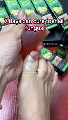 Repair, restore, and flaunt your nails! Ginger Nail Serum - Treat damaged nails with a powerful formula that brings back their natural beauty! #Ginger #NailCare#Vitamin #ginger #nail 