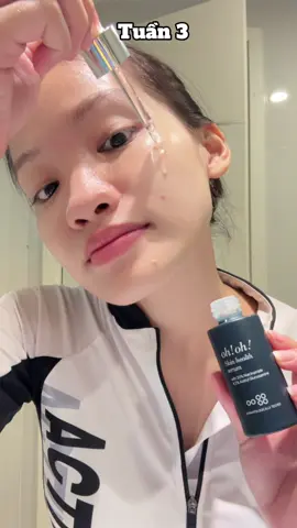 Mới biết thêm 1 serum có 20% Niacinamide siu chất lượng nè 😚😘 #ohohvietnam #niacinamide20 #skinhealth #serumohoh