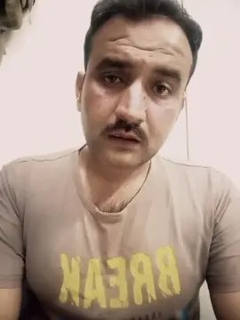 ہزارہ کے لوگوں کے لیے بری خبر، خاص طور پر ایبٹ آباد، ہریپور اور مانسہرہ کے لوگ ہوشیار ہو جائیں۔ ایک انتہائی خطرناک مخلوق آ گئی ہ#hazarawal #mansehra #haripur #abbottabadian #hazara 