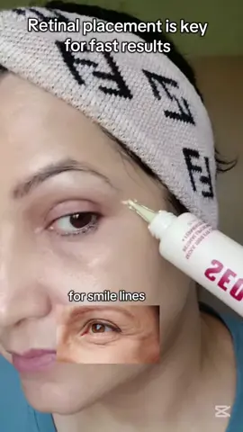 Retinal Seoul 1988 Eye Cream Liposome 4% + fermented bean  Concerns : wrinkles, pigmentation ,skin texture , trouble skin . Benefits: Anti aging, Brightening,Pore care , Improves Texture . @KSECRET GLOBAL  #ksecretglowchallenge #KSECRET #SEOUL1988 #RETINAL #KBEAUTY 