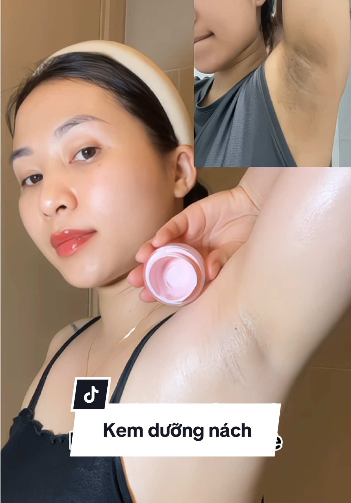 Trộm vía cặp néch hết thâm rồi ạ #kemduongnach #kemgiamtham #thamnach #xuhuong #mebimsua 