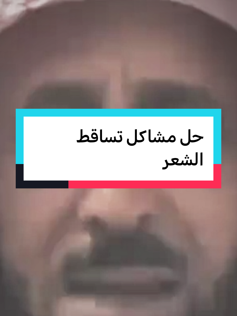 حا مشاكل تساقط الشعر #fypシ゚ #fypviralシ #فهدالقرني 