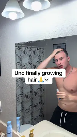 He might be ok #hairgrowth #hairserum #balding #hairline #hairgrowthtips 