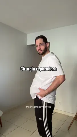 Cirurgia reparadora pós bariátrica #cirurgia #bariatrica #reparadora 