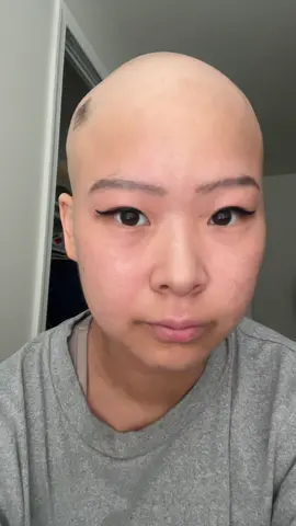 just want to keep it real with everyone…although it’s something I live with everyday it’s still a something I struggle with accepting. That is my alopecia The little, constant reminders everytime I catch myself in a mirror/reflection, raise a hand to swirl my “hair”, or when I’m doing my makeup in the morning… It’s just the insecurities starting to rise up again or the hormones going out of wack lol but nonetheless it’s frustrating to pile on having no hair with other insecurities I have…skin, bloating, eyebrows, eyelashes etc. ROTD: give yourself grace and understanding, we are our own harshest critics…I know I am #alopecia #alopeciaawareness #fyp #urfavbaldie #upanddown 
