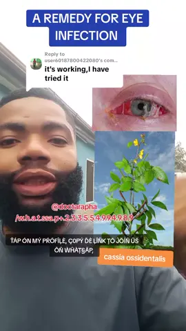 Replying to @user60187800422080 #cassia ossidentalis #eye #fypv #doctarapha #fypviralシviral 