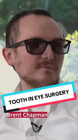In Vancouver, a medical team has successfully carried out Canada’s first “tooth-in-eye” surgeries, a rare and complex procedure known as osteo-odonto-keratoprosthesis (OOKP), which restores sight in people with severe corneal blindness. #toothineye #surgery #transplant #eyetransplant #medicinal 