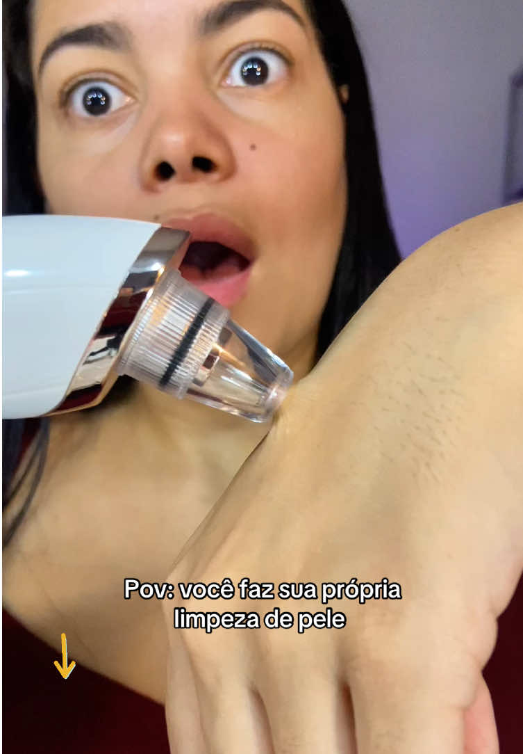 Tirando cravos em casa com esse removedor elétrico #cravoseespinhas #beleza #tiktokshop #tiktokshopbrasil 
