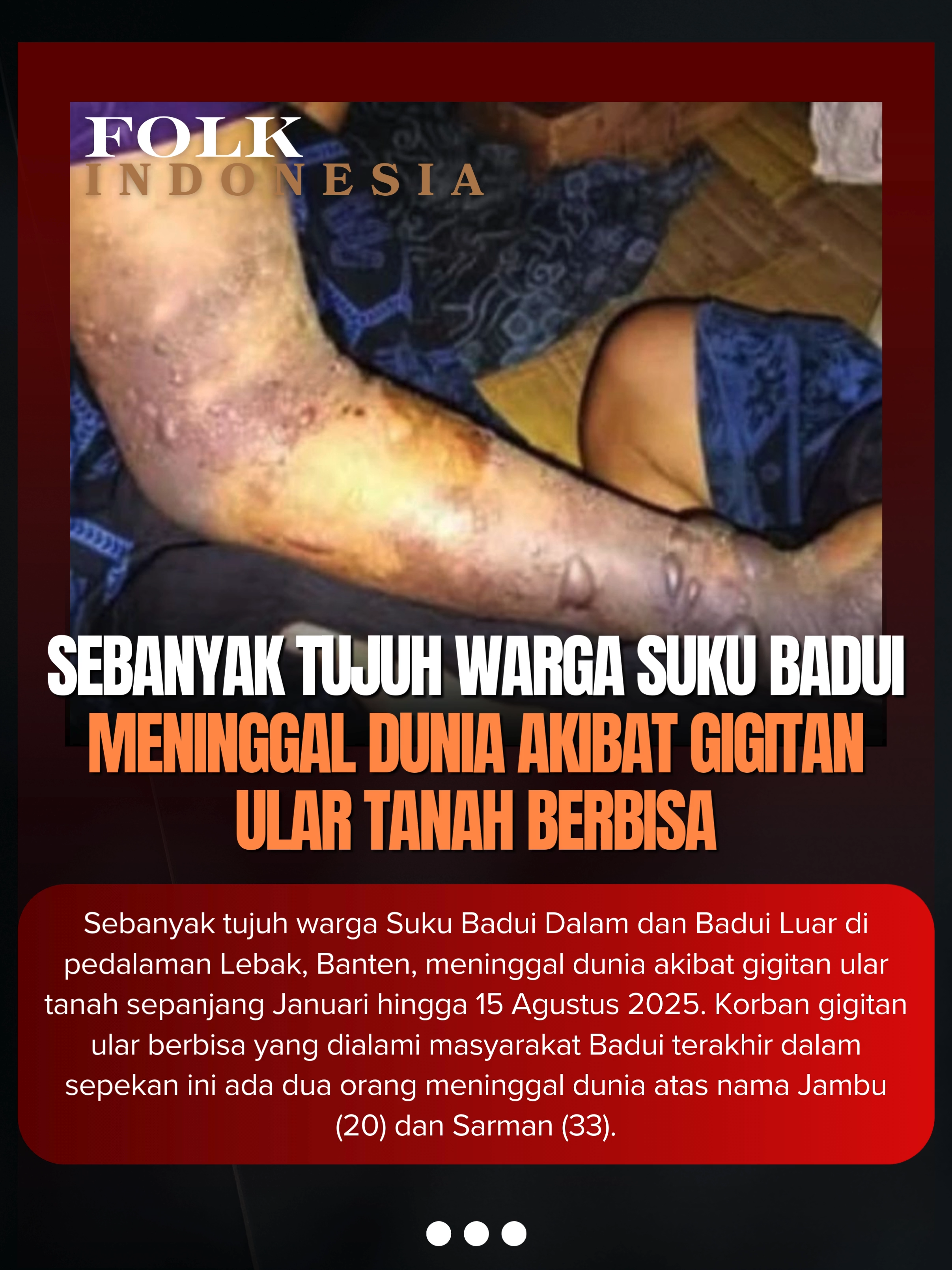 Sebanyak tujuh warga Suku Badui Dalam dan Badui Luar di pedalaman Lebak, Banten, meninggal dunia akibat gigitan ular tanah sepanjang Januari hingga 15 Agustus 2025. 