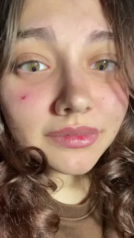 Tengo -20.00 ditriopias, muestro estas porquerías lo que YO QUIERO <333 #fyp #parati #viral #humor #grwm 