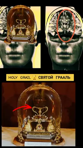 ❤️ АНАТОМИЯ МОЗГА 🧠#holygrail #grail#symbol #кубок#🏆
