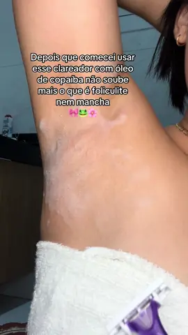 Depois que comecei usar esse clareador não soube mais o que é foliculite nem mancha ❤️ #dicasdebeleza #clareador #clareadordepele 