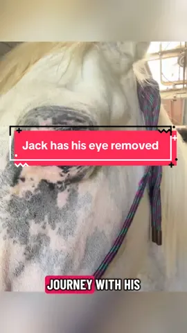 The surgery itself only took about 45 minutes, he had some of the best surgeons, vets, and ophthalmologists in the country to help him. Thank you to UC Davis for taking care of Apple Jack, now known as Cap’n Jack! @Horsepoor4ever  Glaucoma is a condition where fluid inside the eye doesn’t drain properly, leading to a buildup of pressure. In a healthy eye, fluid constantly circulates and drains, keeping pressure balanced. But with glaucoma, that drainage system gets blocked or doesn’t work as it should. The pressure increases and begins damaging the optic nerve, the “cable” that sends visual information from the eye to the brain. Once that nerve is damaged, vision loss is permanent. In Jack’s case, by the time the glaucoma was diagnosed, he had already lost all vision in the affected eye. On top of that, the swelling and pressure from it was causing discomfort and could lead to other complications like chronic pain, eye infections, and even damage to surrounding tissues. Keeping the blind eye might sound less invasive at first, but in reality, it would have meant ongoing pain management, frequent medical care, and the risk of the condition worsening. Removing the eye eliminated the constant pressure, stopped the pain, and removed the risk of further complications, giving Jack a far more comfortable, healthy life going forward.  Edit to add: he was seen by our local vet and referred to Davis for their more advanced tech better equipped to help Jack. #ophthalmology #eyesurgery #glaucoma #horse 
