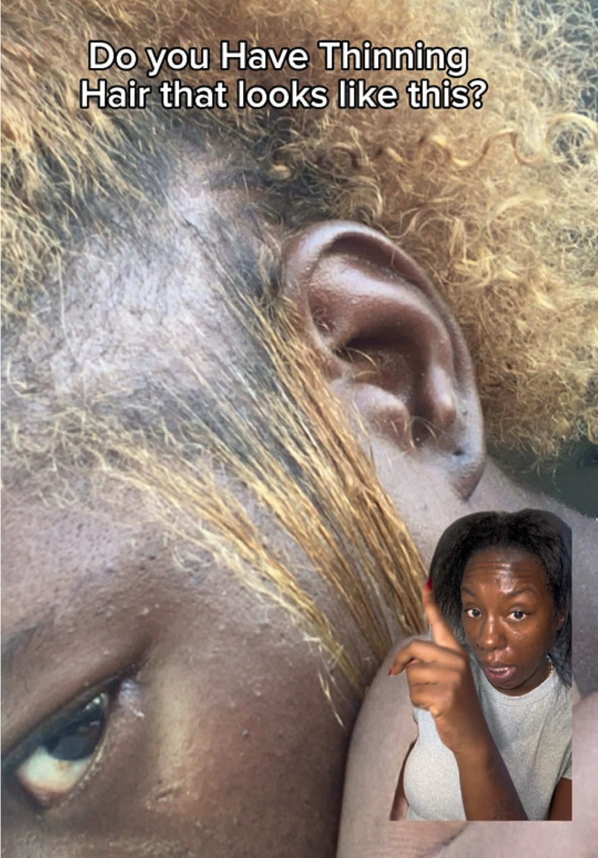 Anyone that has thinning hair, edges or trying to grow hair should try this Be Bodwise Hair growth serum roll-on by @RootLabs #bebodywise #hairgrowth #thinninghair #hairloss #viralvideo 