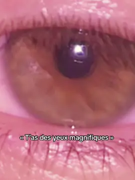 Des yeux magnifiques mais une vue de merde 😔🤡  #fyp #pourtoi #viral #tendance #yeux 